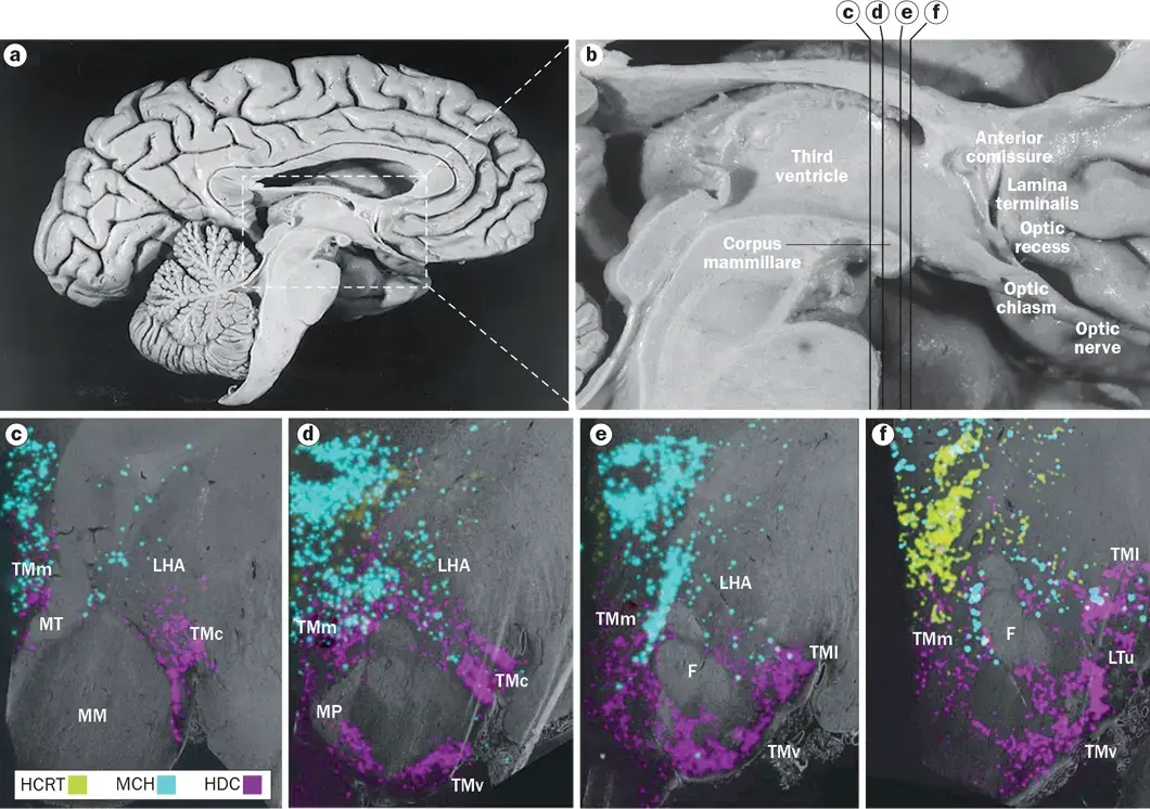 Image of neurons containing histamine, orexin, and MCH in the human hypothalamus