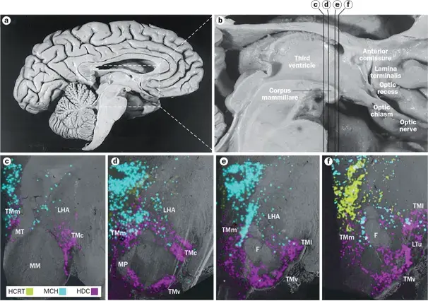 Image of neurons containing histamine, orexin, and MCH in the human hypothalamus