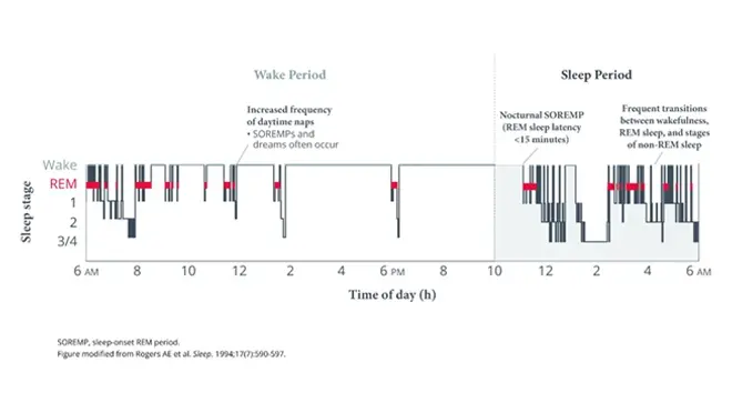 Pathophysiology of narcolepsy video thumbnail