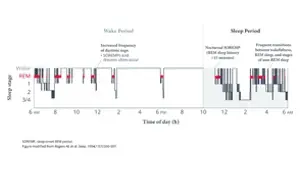 Pathophysiology of narcolepsy video thumbnail