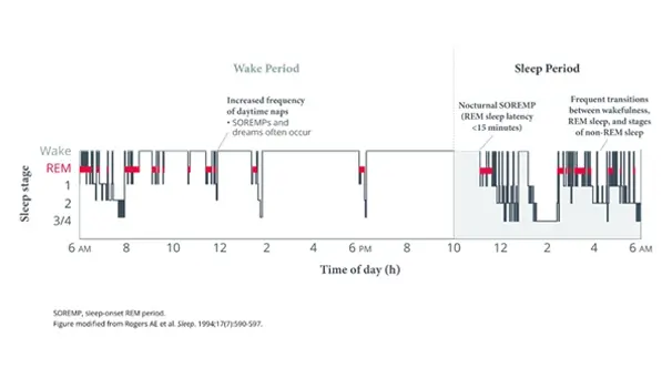 4 3 1 LL Video Pathophysiology Video Thumbnail M